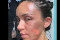 Agresión a una mujer en el club Universitario: el fiscal contó en detalle como fue la agresión