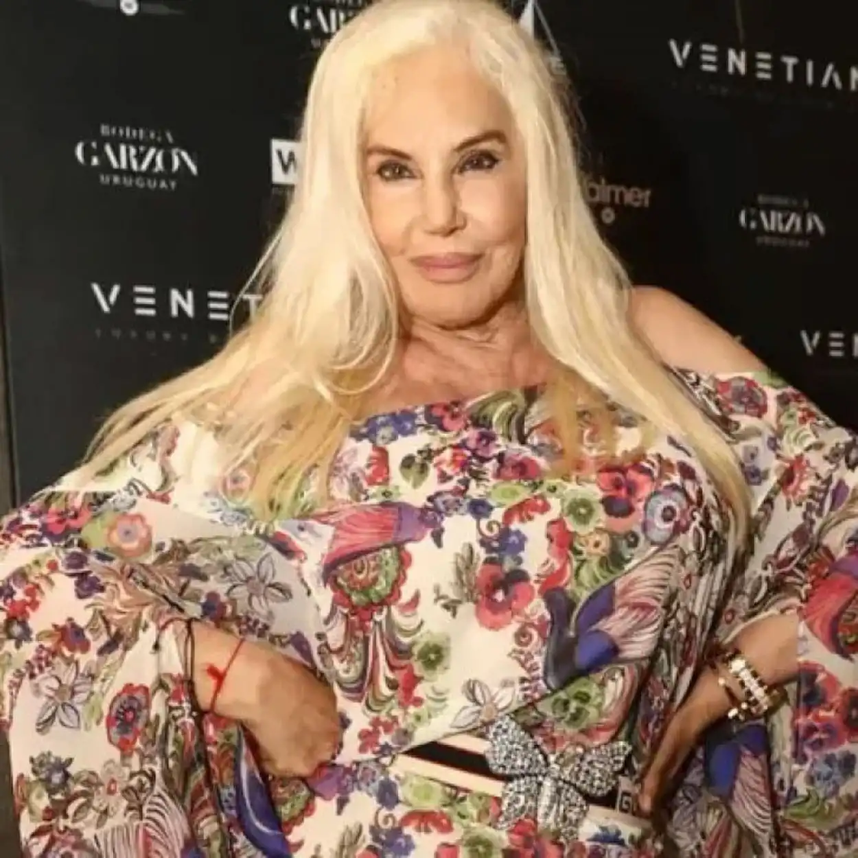 CON VIEJAS DOLENCIAS. Susana Giménez sufre dolores recurrentes.