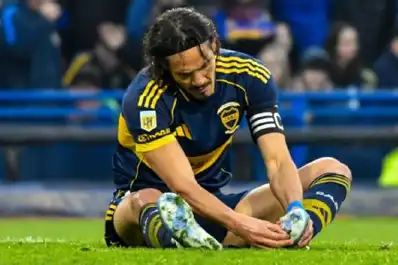 Cavani no jugará ante Universidad Católica y preocupa en Boca