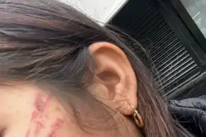 Una joven de 21 años denunció que cuatro mujeres le dieron una golpiza