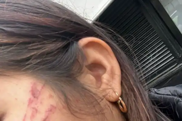 Una joven de 21 años denunció que cuatro mujeres le dieron una golpiza