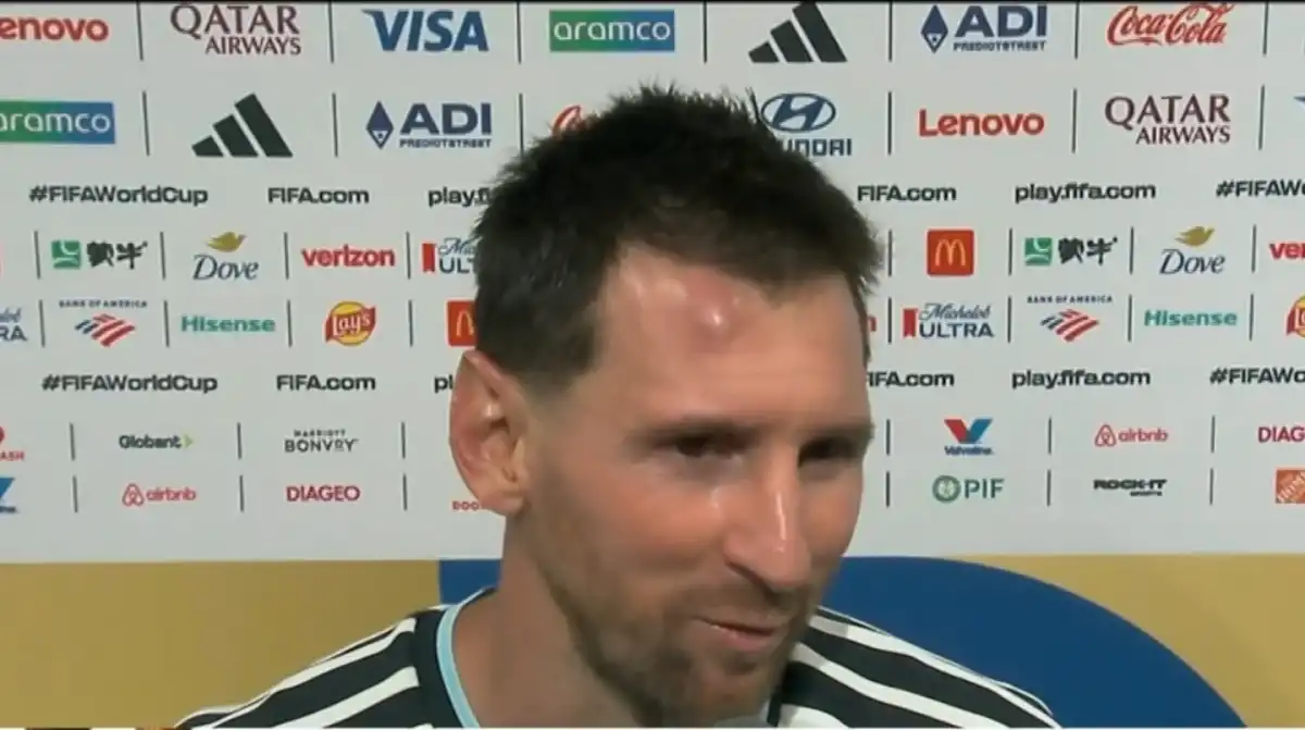 Qué tenía Lionel Messi en la frente después del partido de la Selección contra Cabo Verde