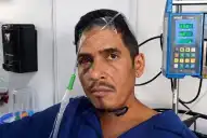 Habló Hernán Gil, el vigilante venezolano que sobrevivió ocho días bajo los escombros por los terremotos