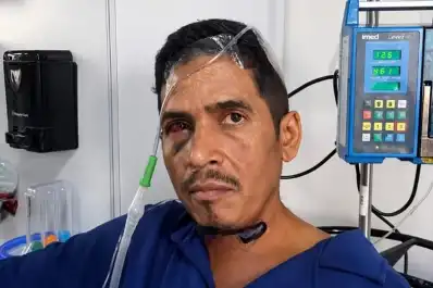 Habló Hernán Gil, el vigilante venezolano que sobrevivió ocho días bajo los escombros por los terremotos