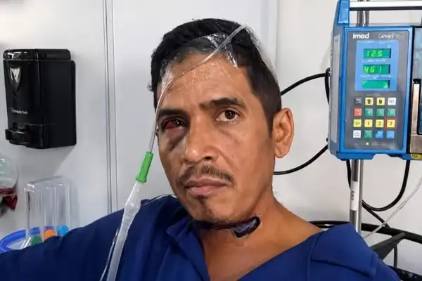 Habló Hernán Gil, el vigilante venezolano que sobrevivió ocho días bajo los escombros por los terremotos