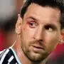 La imagen que preocupó a todos: Messi terminó con un corte en el ojo durante Argentina-Suiza