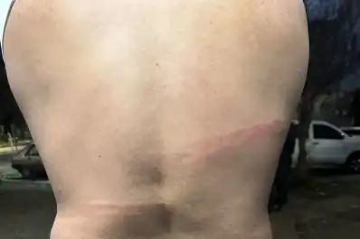 Denuncian a “patovicas” por agresión y robo a una pareja