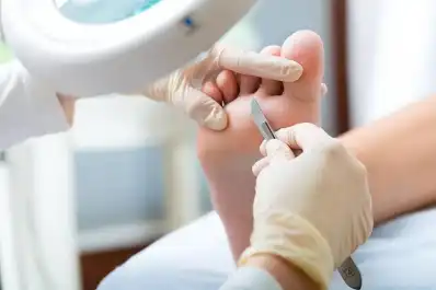 Temperatura, ampollas y heridas: qué cambios en los pies deben preocupar en meses de frío