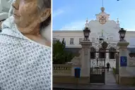 Operaron a una mujer por error en un hospital de Brasil y murió tres días después: la trágica confusión de los médicos