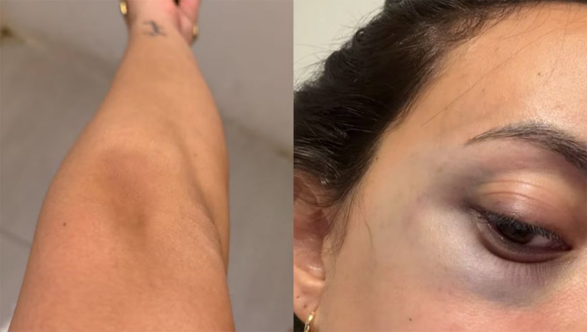 MARCAS. La expareja de Morales denunció golpes y maltratos durante un viaje a México. 