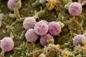 Brote de ciclosporiasis: Estados Unidos registró las dos primeras muertes por la enfermedad intestinal