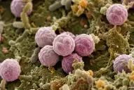 Brote de ciclosporiasis: Estados Unidos registró las dos primeras muertes por la enfermedad intestinal
