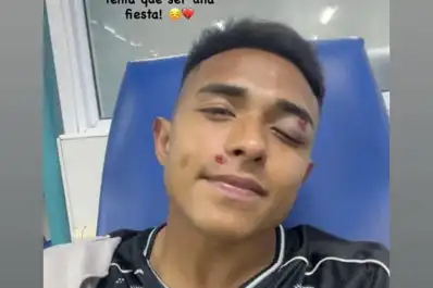 Un delantero de Concepción FC mostró cómo quedó tras recibir un balazo de goma en la final de la Liga Tucumana