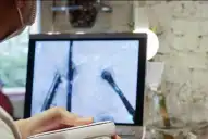 Inteligencia artificial en la peluquería: cómo la tecnología transforma el diagnóstico capilar en Tucumán