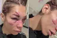 Duro debut en UFC: la cordobesa Sofía Montenegro mostró las impactantes secuelas en su rostro tras una sangrienta batalla en París