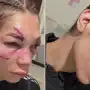 Duro debut en UFC: la cordobesa Sofía Montenegro mostró las impactantes secuelas en su rostro tras una sangrienta batalla en París