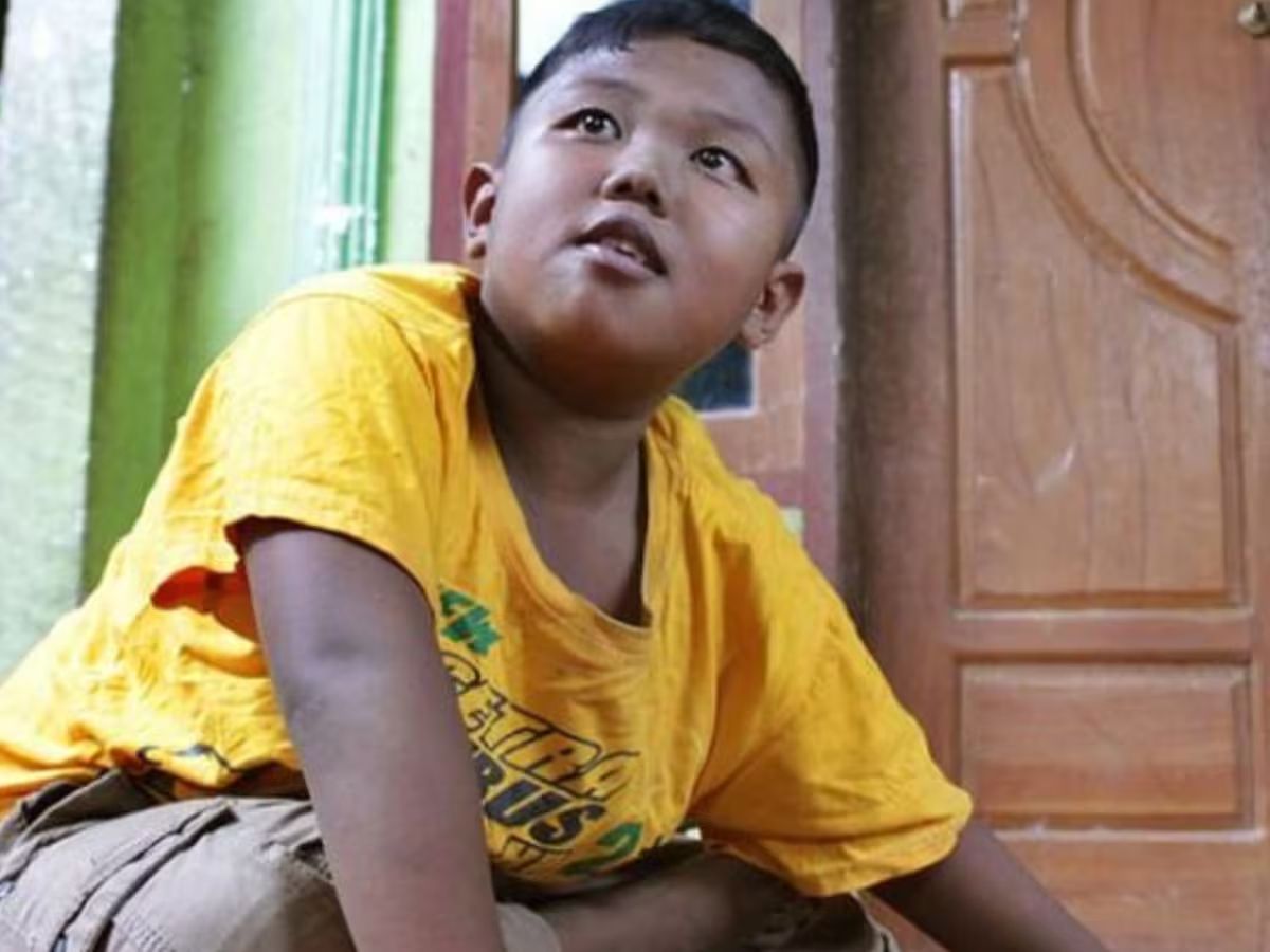 Así luce hoy Adi Rizal, el niño que fumaba 40 cigarrilos por día con tan solo un año y medio