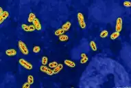 Qué es la peste neumónica: síntomas, contagio y riesgos de la infección que alertó a Rusia