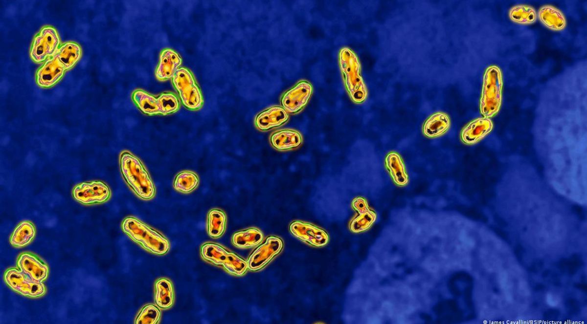 La bacteria Yersinia pestis es la responsable de la peste.Imagen: James Cavallini/BSIP/picture alliance/DW News