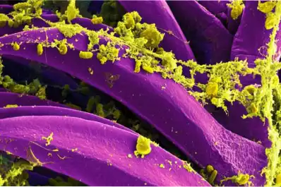 Alerta epidemiológica: cuáles son las probabilidades de que se desate una propagación masiva de peste neumónica