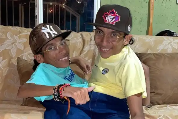 Nacimos juntos, morimos juntos: la historia de los siameses ecuatorianos que fallecieron a los 27 años