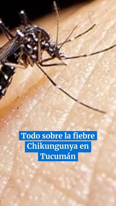 Lo que tenés que saber sobre la fiebre Chikungunya en Tucumán